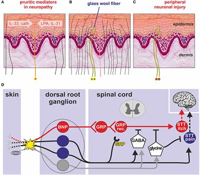 Itch Processing in the Skin